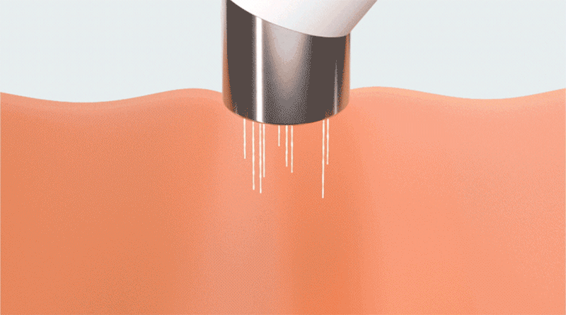 kor-606-998_s9.gif